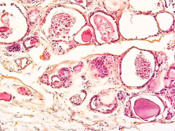 Human Chorionic Gonadotropin